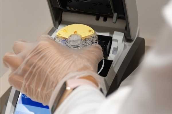 Profilo lipidico